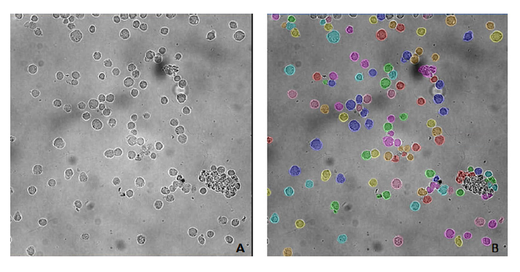 PBMC -Peripheral Blood Mononuclear Cells