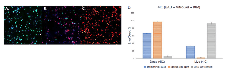 Vitro gel and triple negative Breast cancer cells