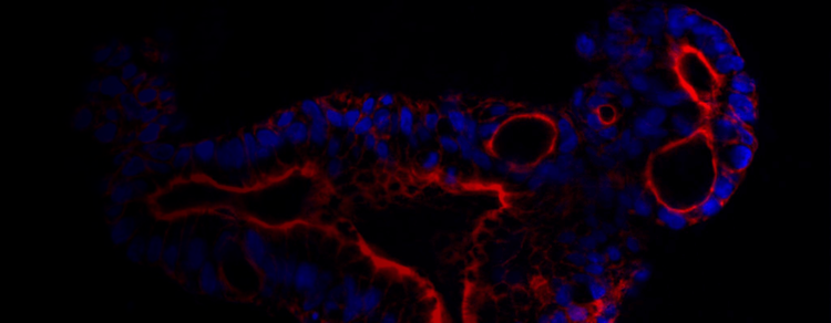 High-throughput modeling of inflammatory bowel disease