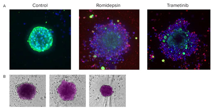 End-point analysis of fluorescent images was done using Custom Module Editor ImageXpress