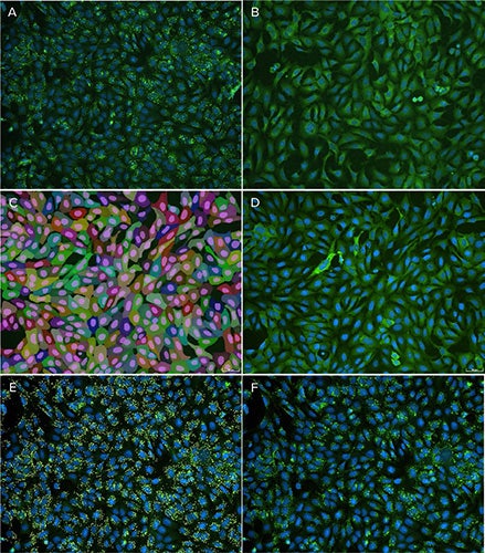 GPCR activation assay showing β-arrestin puncta, controls, and segmentation masks