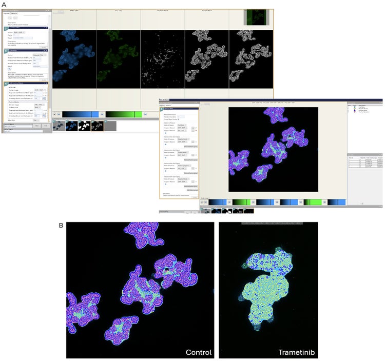 CME analysis masks and untreated organoids and organoids treated with trametinib