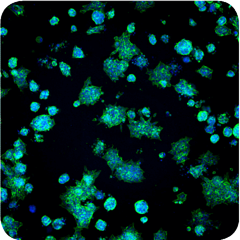 spheroids-matrigel-stained-with-hoechst