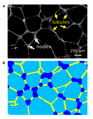 Automatic quantification of tubular network