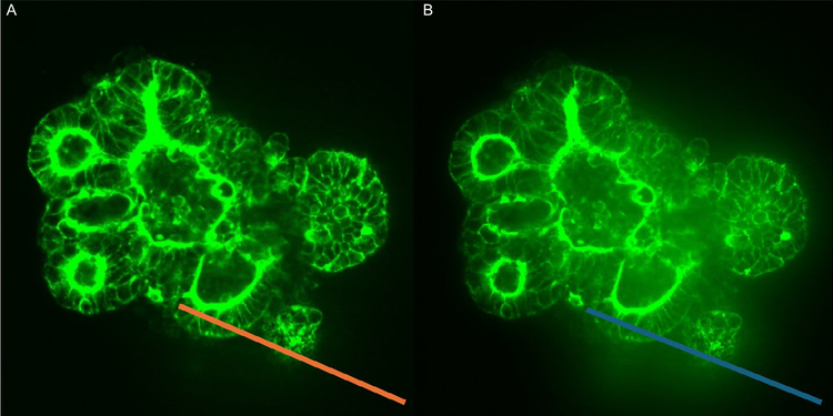 A. CRC image acquired with 50um pinhole deep tissue disk; B. CRC image acquired with 60um pinhole confocal disk
