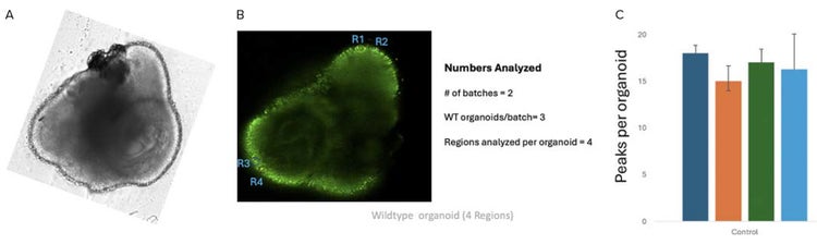 TL image of wild-type retinal organoid captured using confocal microscope