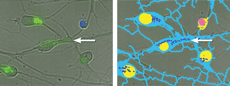 Neuron segmentation using a custom module