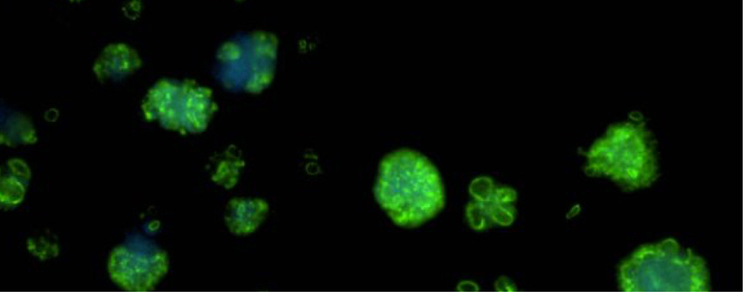 patient-derived organoids