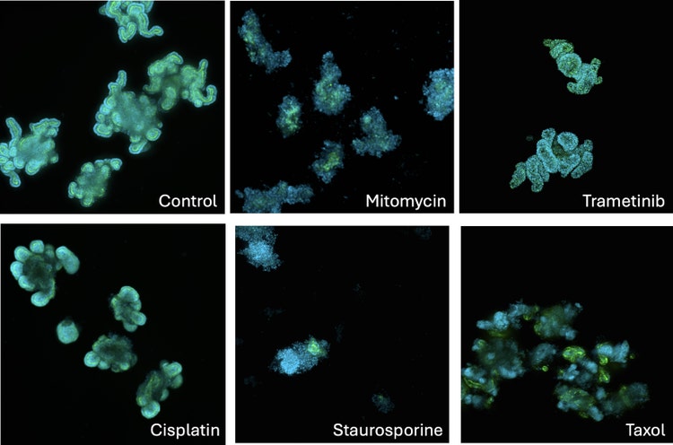 Pehnotypic changes caused by selected cytotoxic drugs