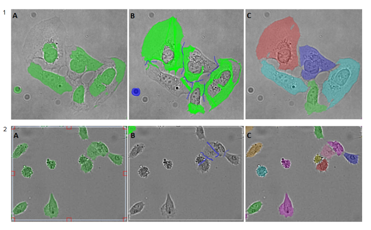 Hela cells image and U2OS cells image