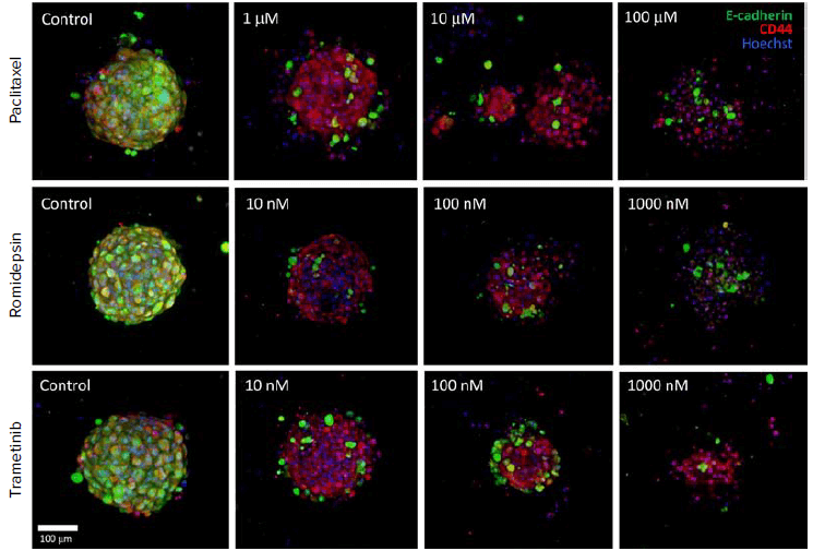 Tumoroids incubated with compounds for E-Cadherin and CD44