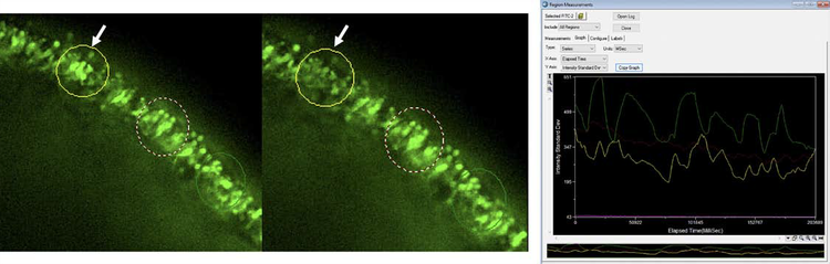 20x images of retinal organoid that show Calcium 6 fluorescence activity