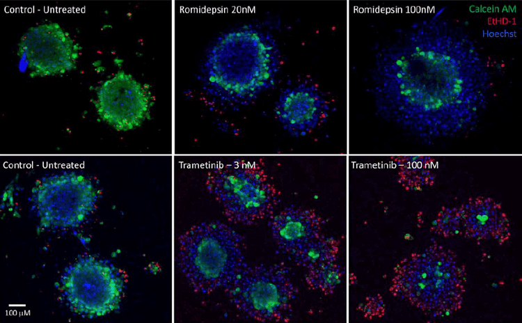 mages of tumoroids treated with romidepsin