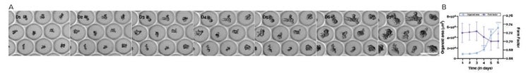 Comparison of human rectal organoid cultures grown on Gri3D or within solid-ECM drops