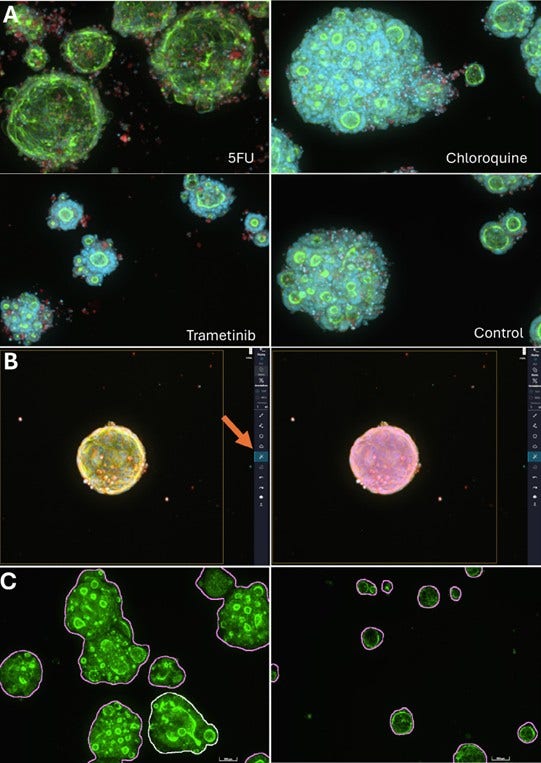 Representative image showing colorectal cancer (CRC) organoids treated with 5-Fluorouracil (5FU), Chloroquine, Trametinib, and untreated control