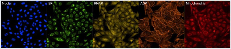Cell Painting assay
