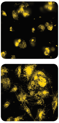 measuring-mitochondrial-1