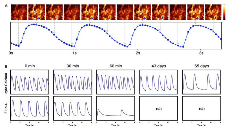 Time-lapse image series of contracting iPSC-derived cardiomyocytes