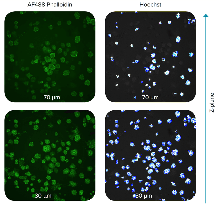 Z-planes of spheroids in Matrigel