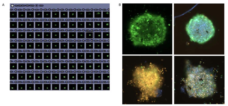 3D spheroid images with CellXpress.ai