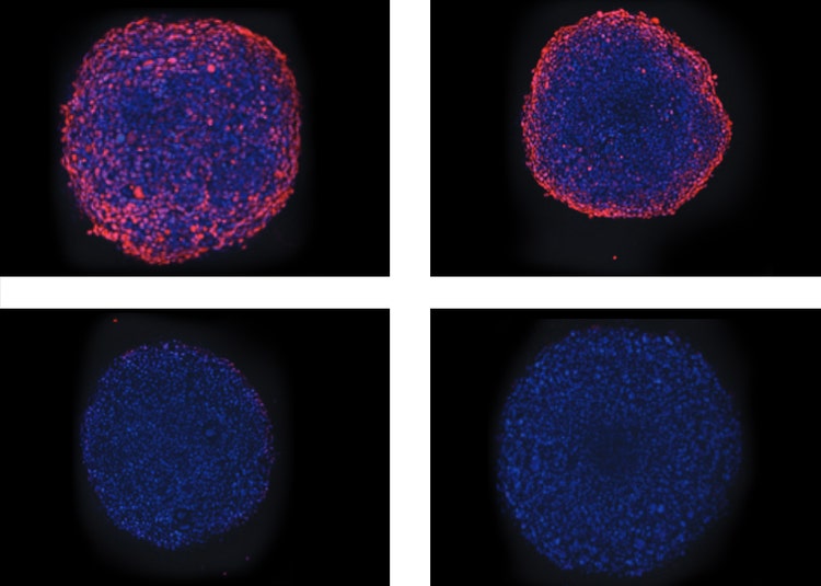 Toxic effect of Antimycin A on mitochondria