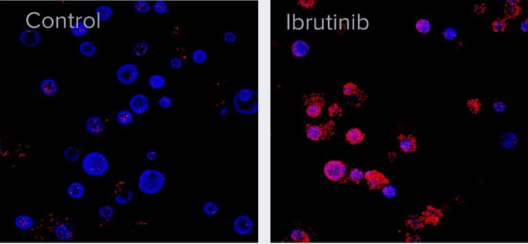 Organoids Stained with Hoechst Nuclear Dye