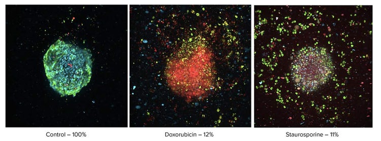 Evaluation morphological changes using high-content imaging