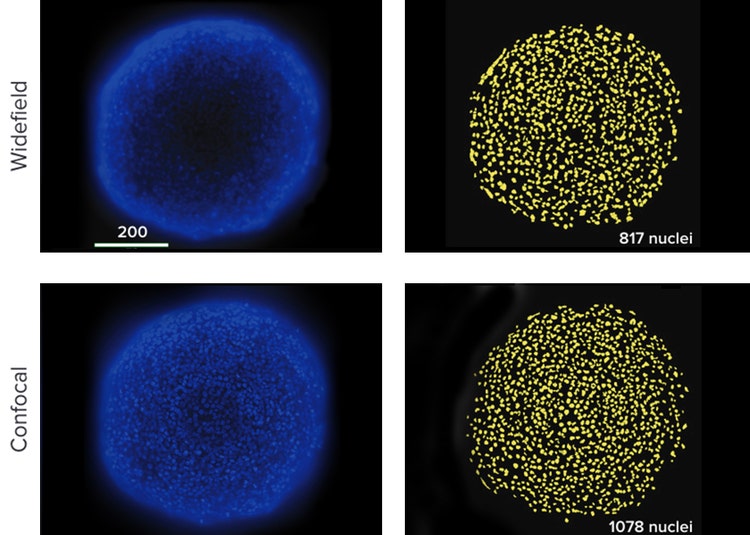 HCT116 spheroid taken with widefield optics