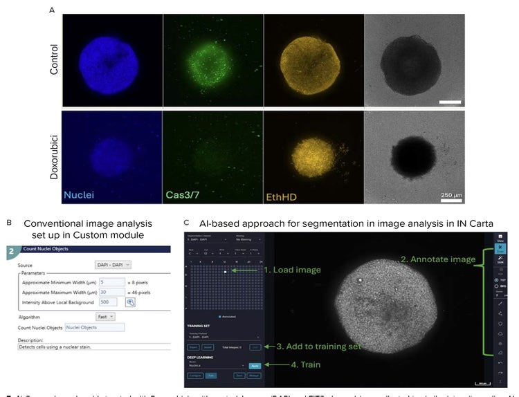 Comparing spheroids treated with Doxorubicin with control-and-detection