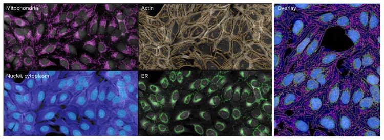IN Carta software to segment the various cellular structures