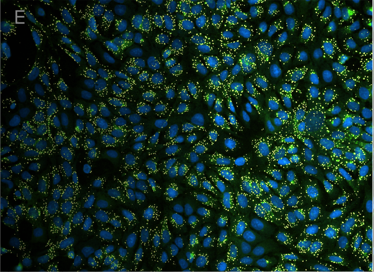 RT Kragle LED system