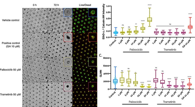 Response of pancreatic cancer PDOs exposed to anti-cancer compounds for 72 hours