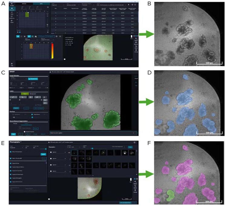 A, B. images were first exported and opened in IN Carta and C, D. Single organoids were using custom SINAP model in TL