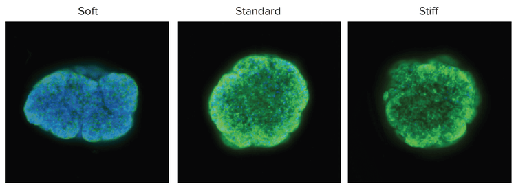 MCF-7 spheroids cultured in three VersaGel stiffnesses