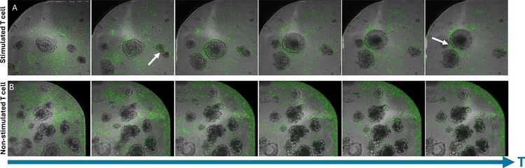 Stimulated T-cells appeared to displace organoids in culture