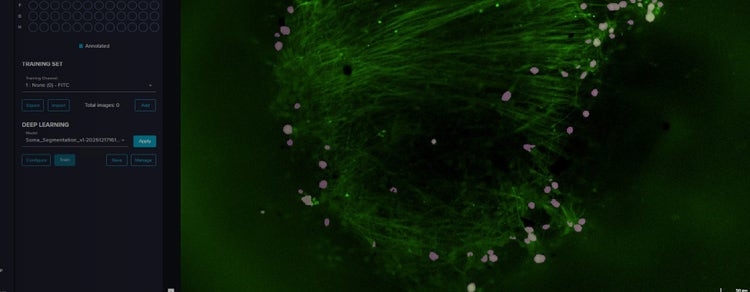 Human Brain Organoids