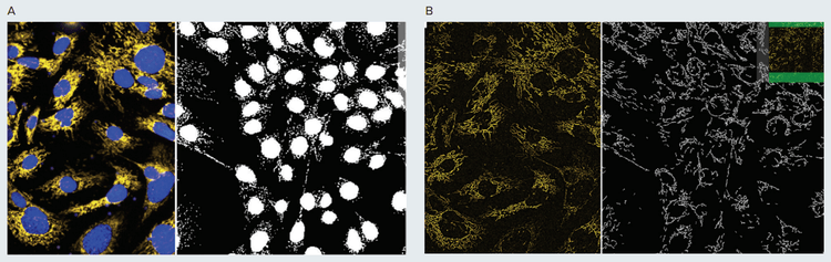 Phenotypic analysis of mitochondria shape