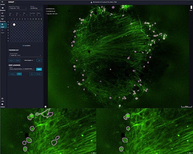 SINAP module interface in IN Carta with comparison of cell body segmentation using pretrained versus retrained Cellpose models