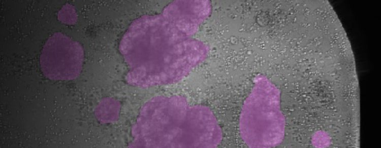 T-cell Morphological