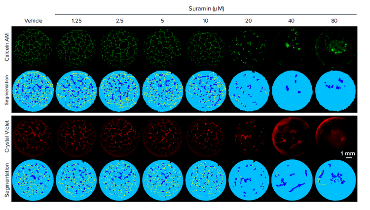 Dose-dependent Anti-angiogenic Effect Of Suramin