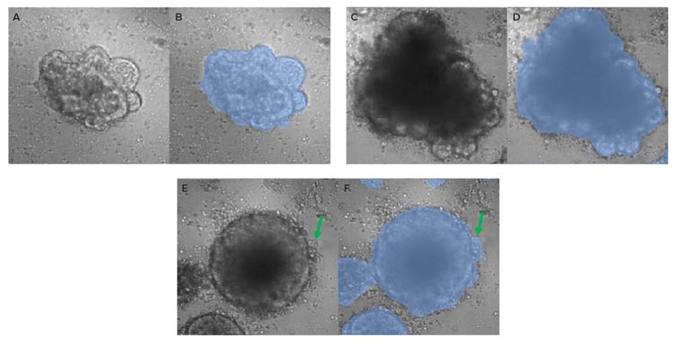 Representative TL image and corresponding segmentation of intact organoids at the first timepoint with stimulated T-cells