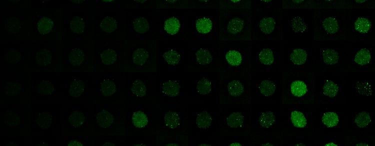 human iPSC-derived cardiomyocytes