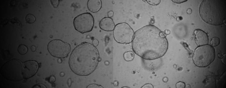 Human Intestinal Organoid Screening