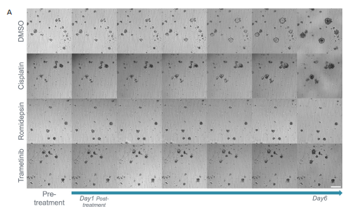 Organoids were treated with 5FU