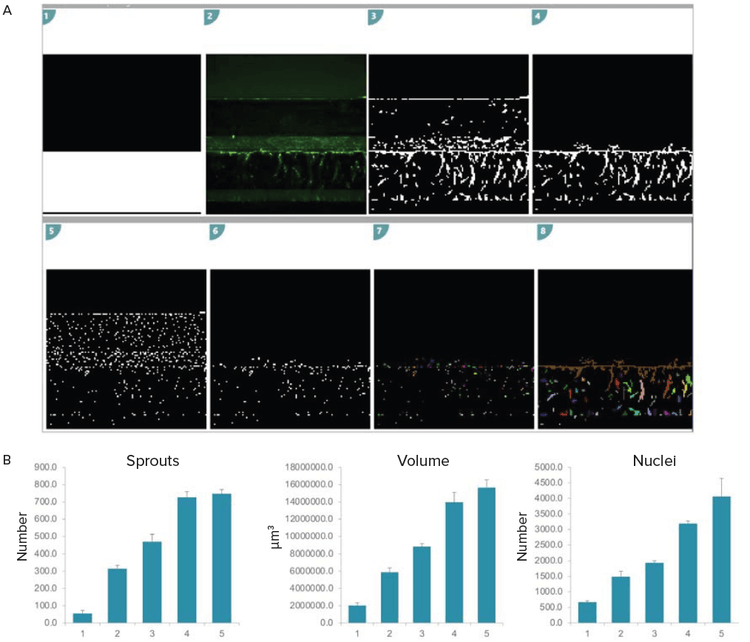 3D analysis of angiogenic sprouts