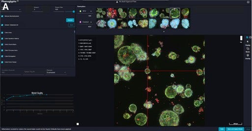 Phenoglyphs screenshot showing two chosen classes, the ranking features, model quality and the exemplars