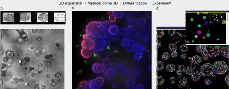 Organoids in Matrigel dome after four weeks in culture