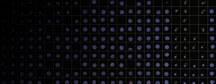 Screening of 3D spheroids