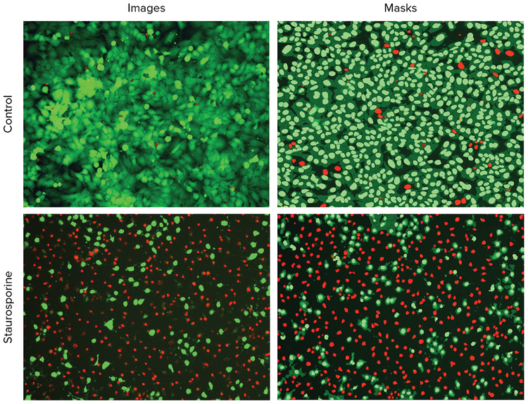 Representative images of negative control cells