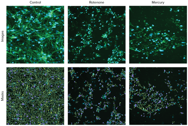 representative-images-of-neurons-with-ß-tubulin